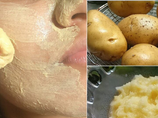 Skin Problems : చర్మ సమస్యలకు చెక్‌పెట్టే బంగాళాదుంప