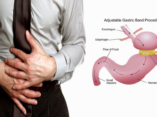 Gastric: ఇలా చేస్తే గ్యాస్ట్రిక్‌ సమస్య నుంచి బయటపడొచ్చు