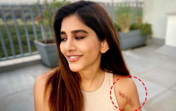 Nabha Natesh:యాక్సిడెంట్ గురించి ఆల‌స్యంగా చెప్పిన న‌భా న‌టేష్‌