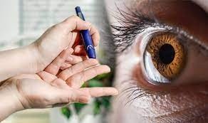 Diabetic Eye Disease:- మధుమేహం మీ కళ్లలోనే తెలిసిపోతుంది!