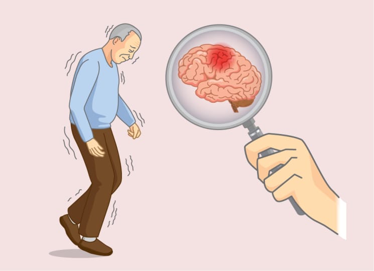 Alzheimers : అల్జీమర్స్‌ను కనిపెట్టగల స్మార్ట్ ఫోన్ టెక్నాలజీ..