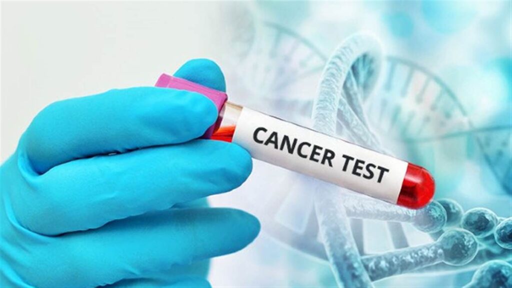 Cancer:- ఇంట్లోనే క్యాన్సర్‌కు టెస్ట్.. సెన్సార్ ద్వారా..