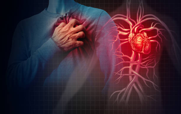 Types of heart attack  : గుండెపోటు అయిదు రకాలు.. ఏఐ వివరణ..