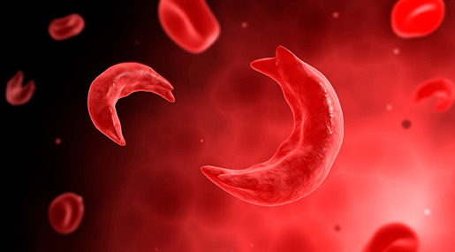 sickle cell : సికిల్ సెల్‌కు జీన్ థెరపీ