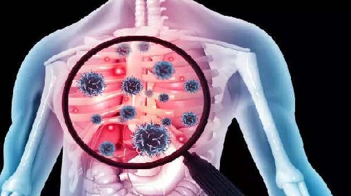 Tuberculosis- TB : టీబీ కోరల్లో ప్రపంచం