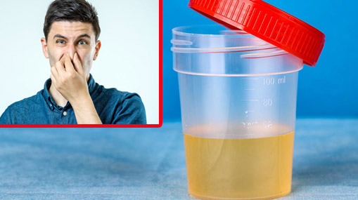 Urine odor : యూరిన్ బ్యాడ్ స్మెల్ వస్తుందా ?.. ఈ వ్యాధులు ఉన్నాయోమో..!