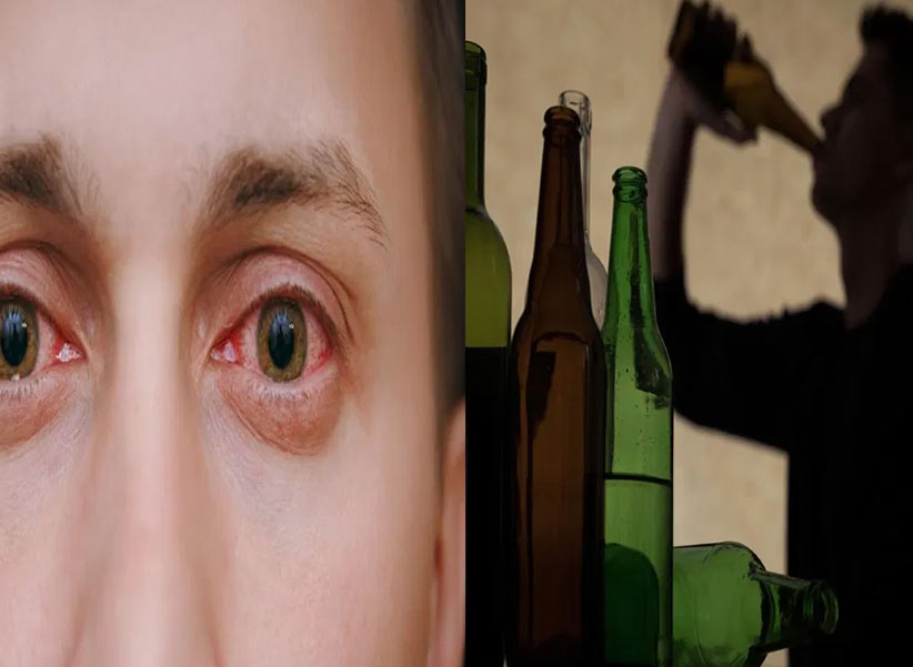 Alcohol Effects On Eyes: మందు బాబులకు అలర్ట్.. ఆల్కహాల్ తాగితే మీ కళ్ళు ఖతం!