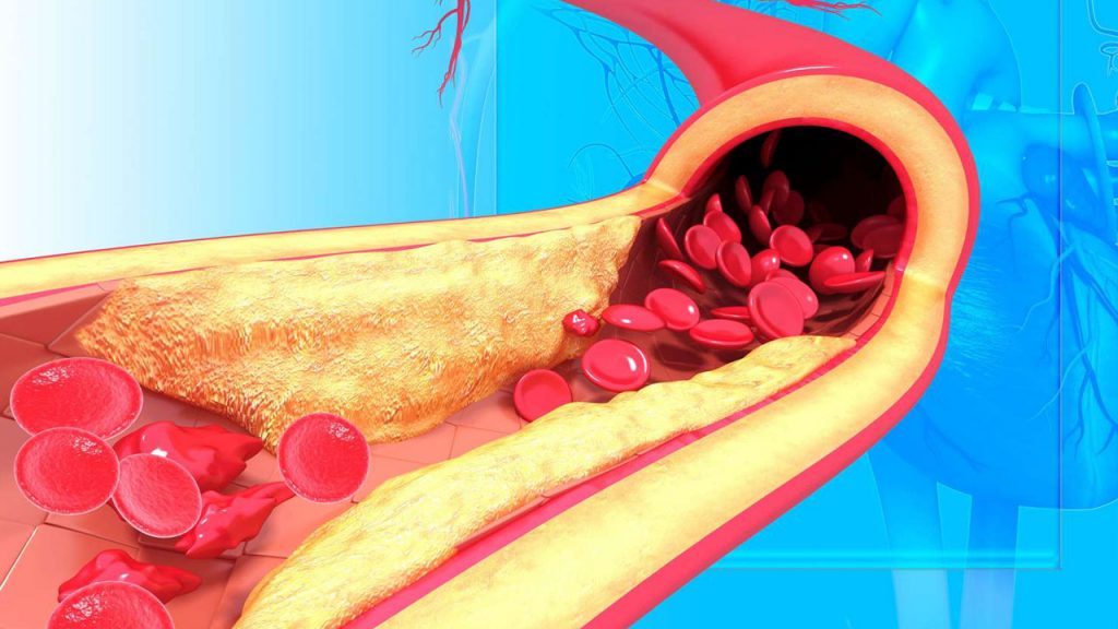 Cholesterol Control Tips