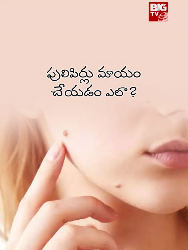 పులిపిర్లు మాయం చేయడం ఎలా?