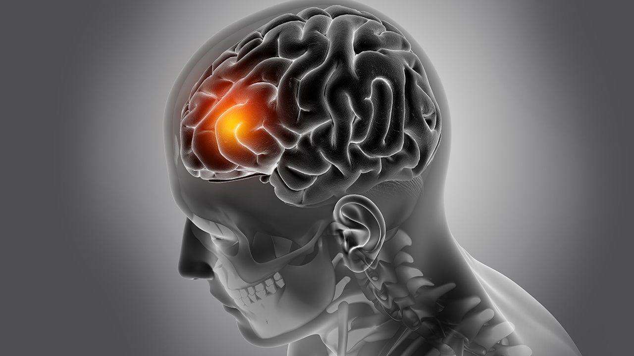 brain tumor symptoms