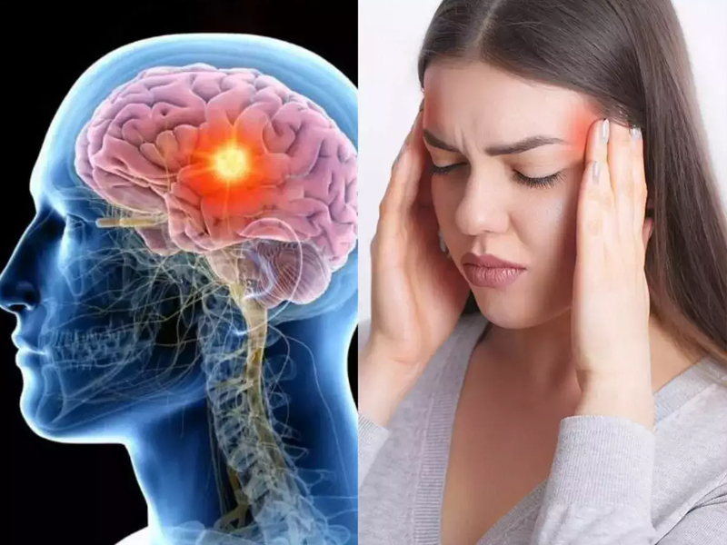 Brain Tumor : ఈ ప్రదేశంలో తరచూ నొప్పి ఉంటుందా.. బ్రెయిట్ ట్యూమర్ కావొచ్చు!