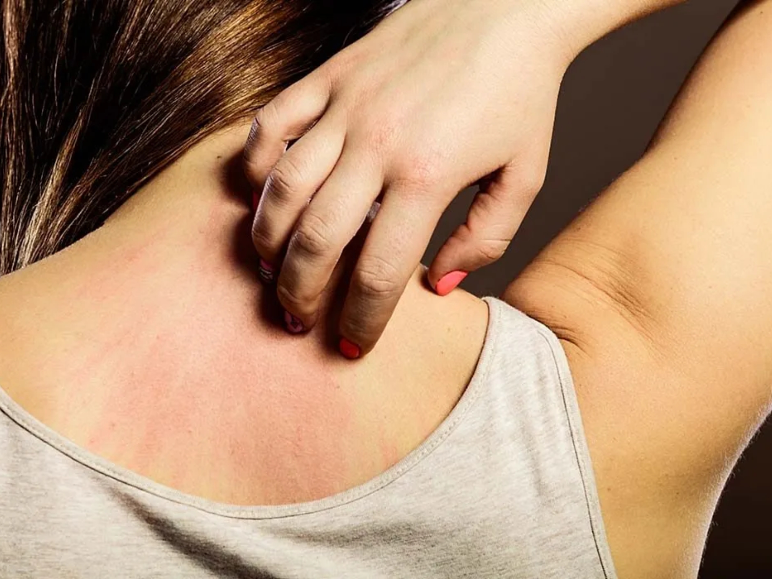 Causes of Itching: దురద ఎందుకొస్తోంది..? గోకితే ఎందుకు పోతోంది..?