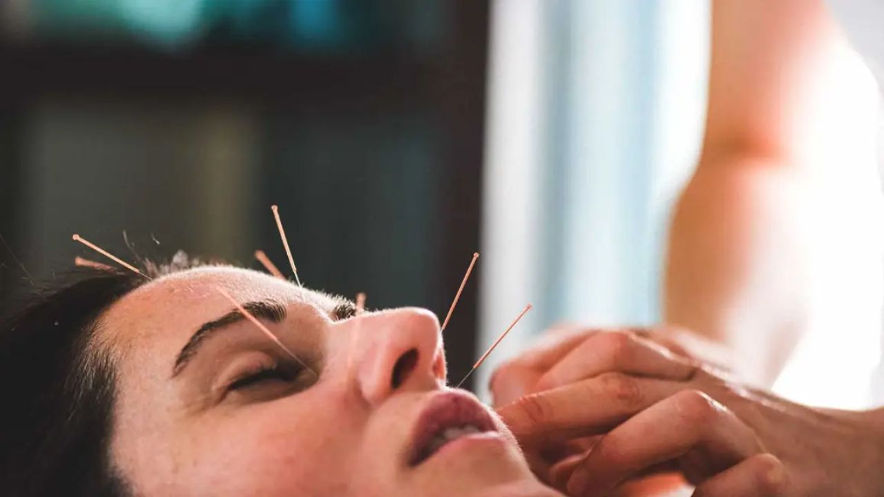 Acupuncture : ఆక్యుపంక్చర్‌ చికిత్స అంటే ఏమిటి? ఇది ఎలా పనిచేస్తుంది?