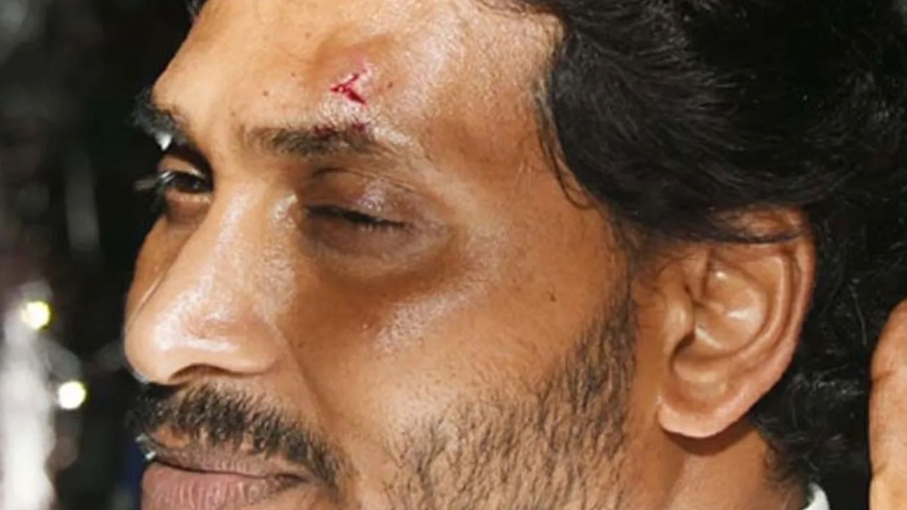 CM Jagan Stone Pelting Case: జగన్‌పై రాయి దాడి కేసులో నిందితుడికి బెయిల్..!