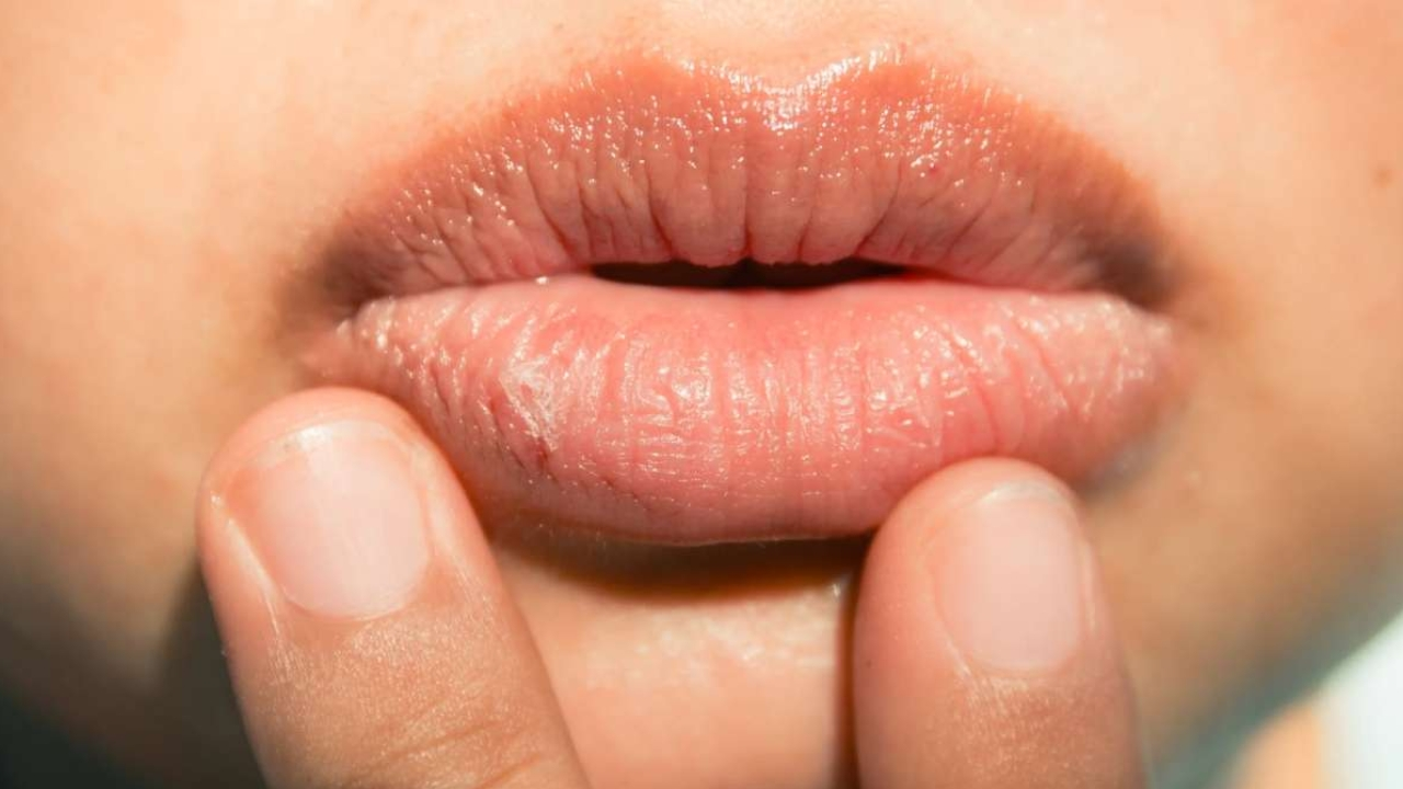 Chapped Lips in Summer: వేసవికాలంలో పెదవులు పొడిబారడానికి కారణం తెలుసా..? ఈ చిట్కాలు పాటిస్తే అంతా సెట్!