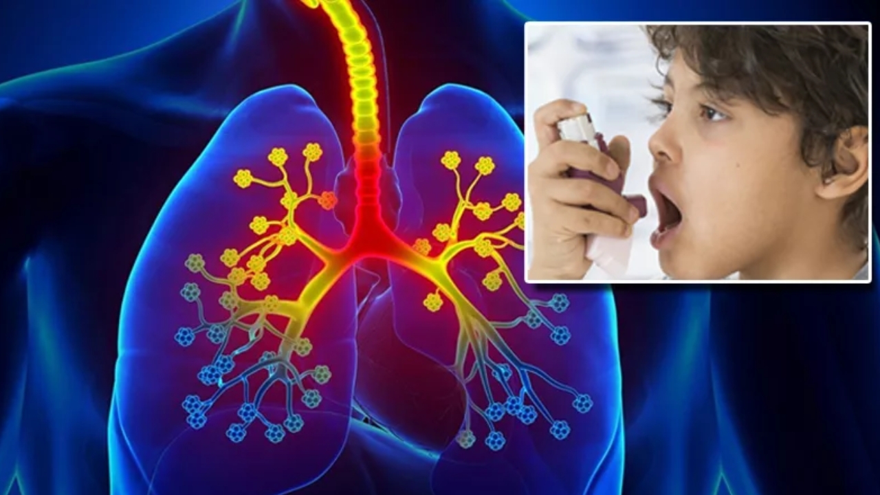 Stages of Asthma: ఆస్తమాలో 4 దశలు.. ఇందులో ఏది అత్యంత ప్రాణాంతకమో తెలుసా..?