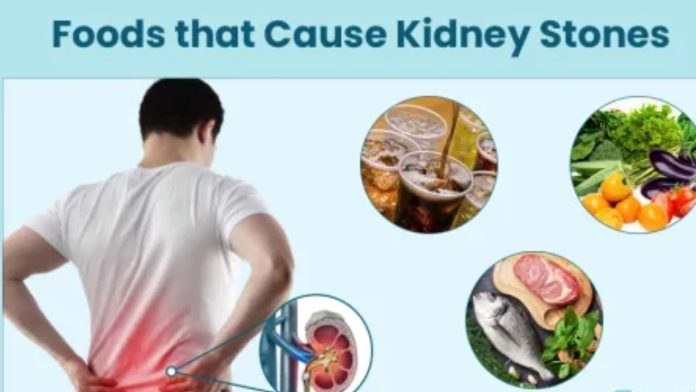 foods that cause kidney stones