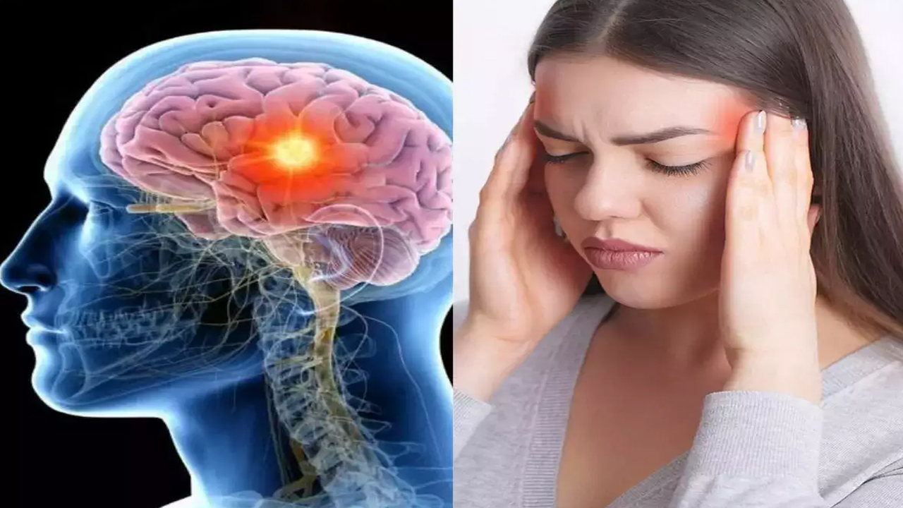 Brain Tumor Diseases: తలనొప్పిని నిర్లక్ష్యం చేస్తున్నారా.. బ్రెయిన్ ట్యూమర్ లక్షణాలు కావొచ్చు..