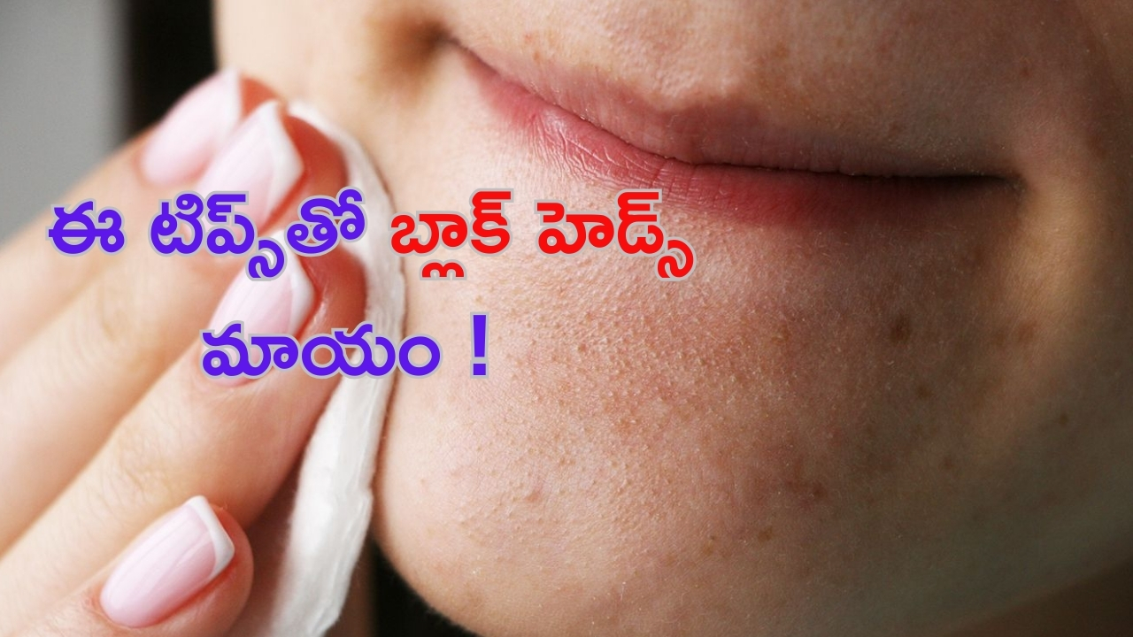 Blackheads Removal Tips: బ్లాక్‌హెడ్స్ తో ఇబ్బంది పడుతున్నారా..? అయితే ఈ టిప్స్ మీ కోసమే