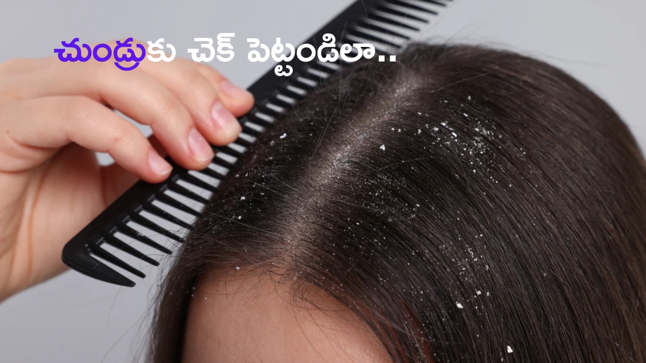 Dandruff Control Tips: చుండ్రు సమస్యతో విసిగిపోయారా ? ఈ టిప్స్‌తో చెక్ పెట్టండి