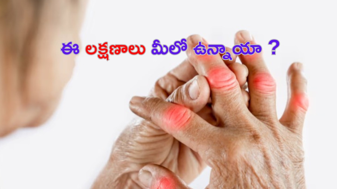 Calcium Deficiency: ఈ లక్షణాలు మీలో ఉన్నాయా ? అయితే క్యాల్షియం తగ్గినట్టే