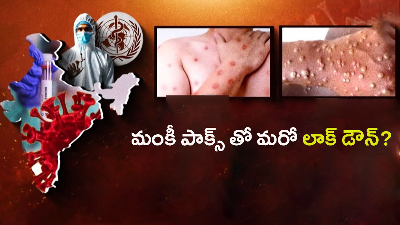 Monkey Pox Virus: వణికిస్తున్న మంకీ పాక్స్.. మరో లాక్ డౌన్ తప్పదా?