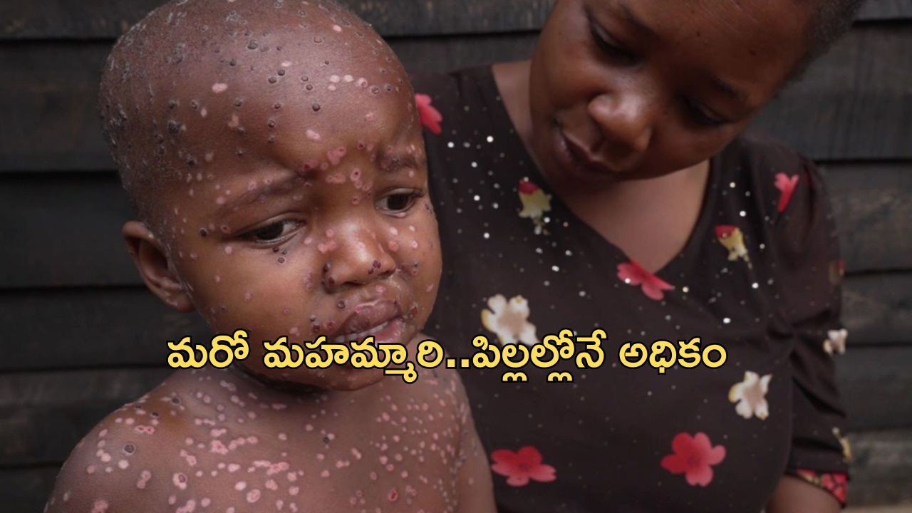 Congo’s Mpox Crisis: ఓ మైగాడ్.. ఆ వైరస్‌తో ప్రమాదంలో పిల్లలు.. 80 శాతం మరణాలా!