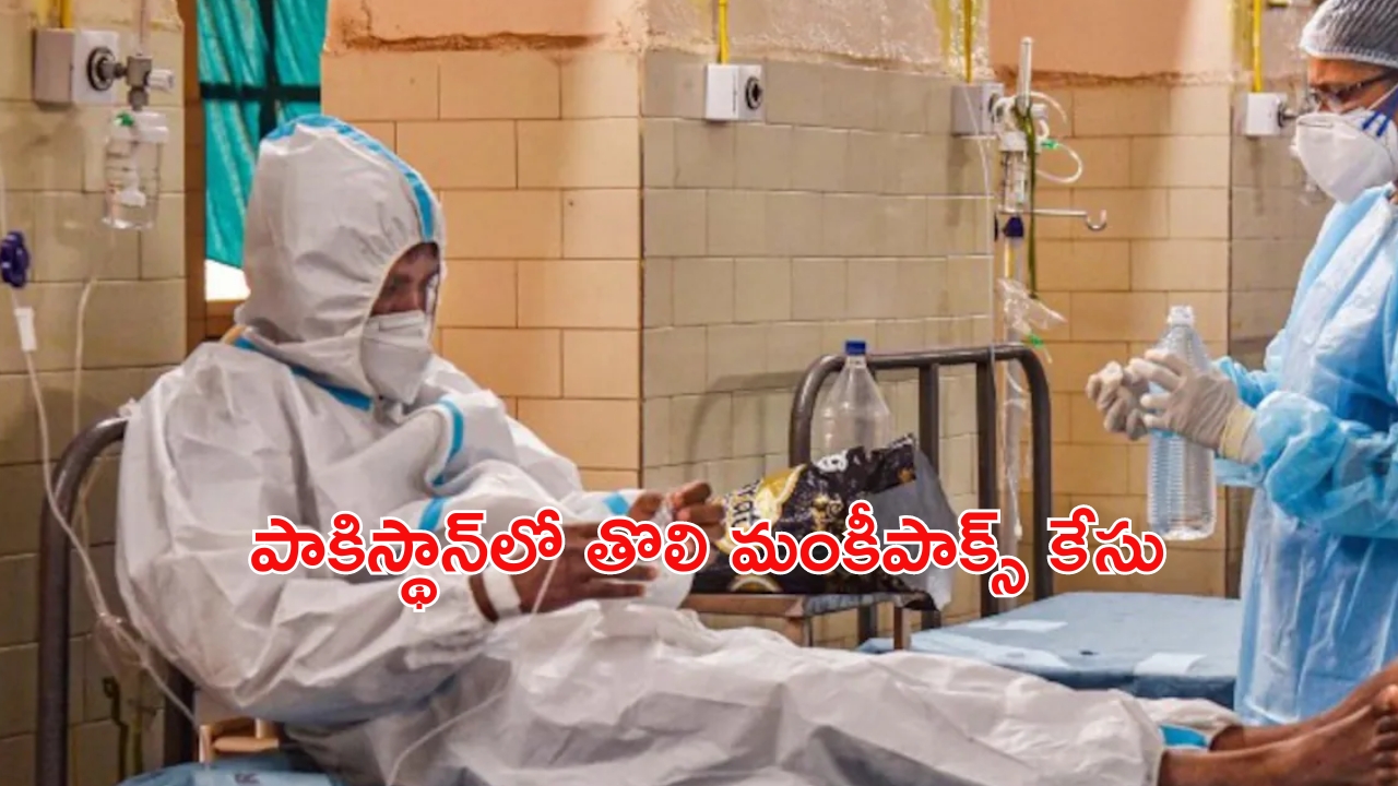 Monkeypox Case: పాకిస్థాన్‌లో ముగ్గురికి మంకీపాక్స్‌ పాజిటివ్.. భయాందోళనలో పొరుగు దేశాలు.. లక్షణాలు ఇవే!