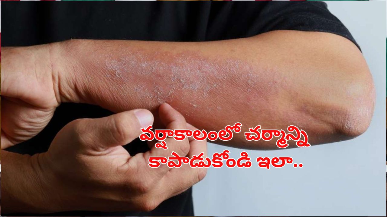 Rainy season Skin Problems : వర్షాకాలంలో చర్మ సమస్యలు.. పాటించాల్సిన చిట్కాలు!