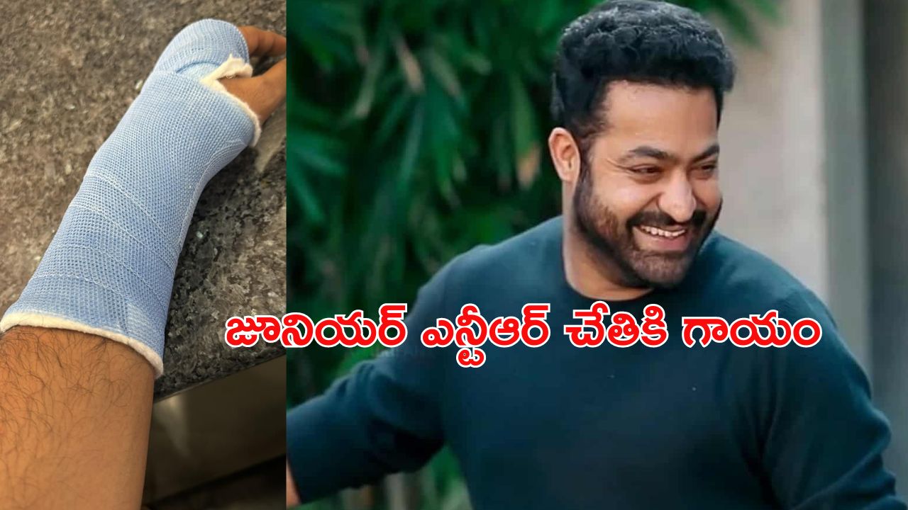 JR NTR : ఎన్టీఆర్ కు గాయం నిజమే.. కానీ ?