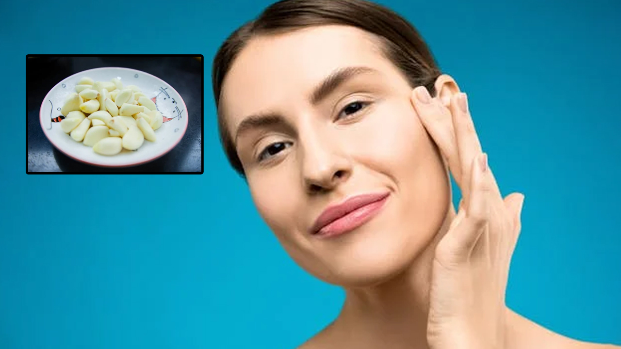 Acne and Garlic: పచ్చి వెల్లుల్లిని ముఖంపై ఉన్న మొటిమలపై రుద్దితే అవి తగ్గిపోతాయా?