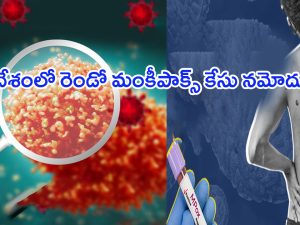 Monkeypox Case in India: భారత్‌ను వణికిస్తున్న మంకీపాక్స్.. రెండో కేసు నమోదు.