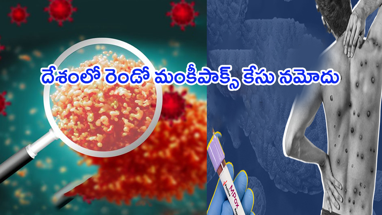 Monkeypox Case in India: భారత్‌ను వణికిస్తున్న మంకీపాక్స్.. రెండో కేసు నమోదు.