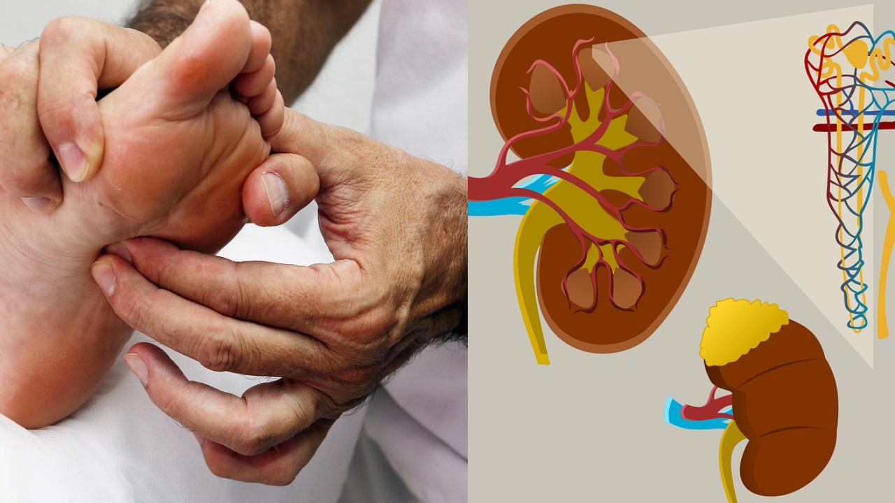 Kidney Cancer Symptoms: ఈ లక్షణాలు మీలో ఉన్నాయా ? జాగ్రత్త !