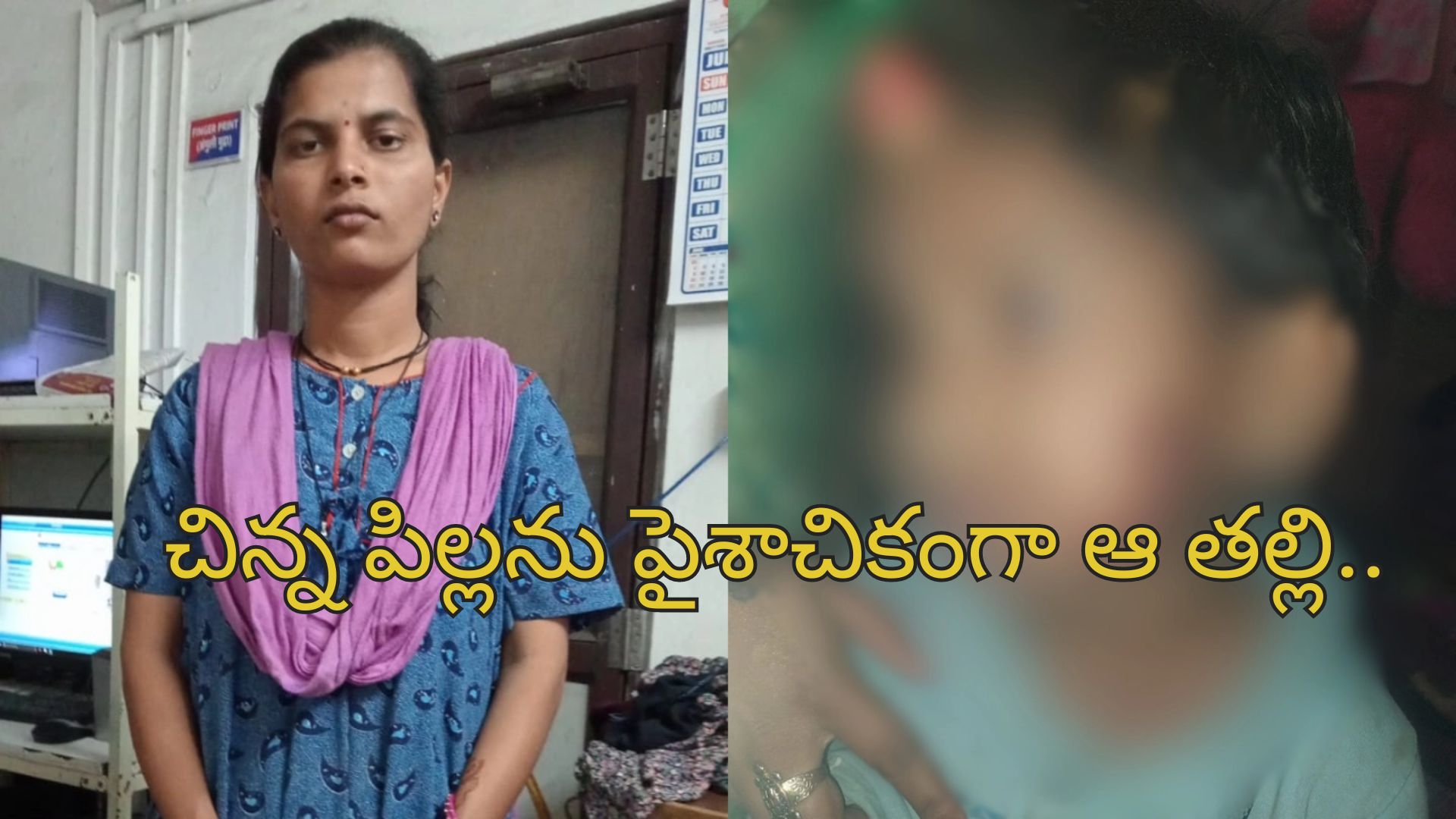 Woman Burns Step-Daughter: 5 ఏళ్ల పాప ప్రైవేట్ భాగాలు, నోటిపై వాతలు పెట్టిన మహిళ.. ఆ పాప ఏం చేసిందంటే?..