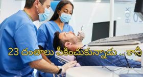 Man Extracts 23 Teeth: ఒకేరోజు 23 పళ్లు తీయించుకున్నాడు.. తిరిగిరాని లోకాలకు వెళ్లిపోయాడు..!