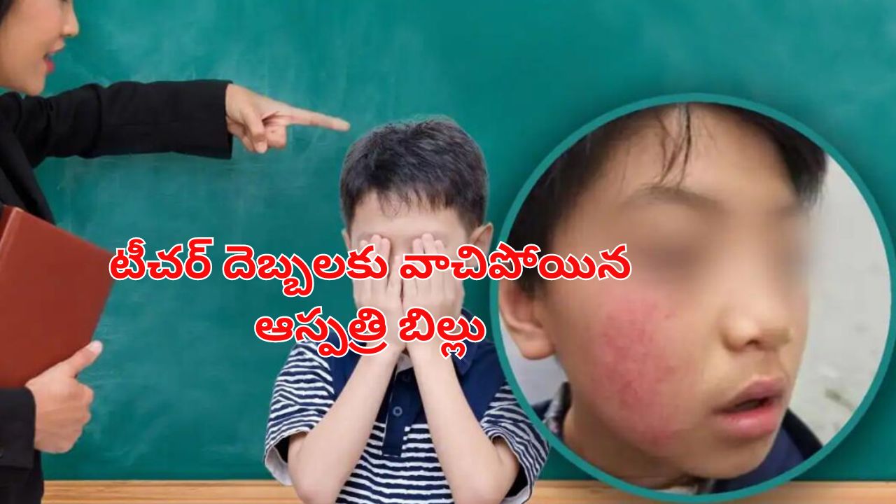 China Schoolboy Vitiligo: టీచర్ చేసిన పనికి.. ఆ విద్యార్థికి వింత చర్మ వ్యాధి, మరీ అలా శిక్షిస్తే ఎలా బాస్?