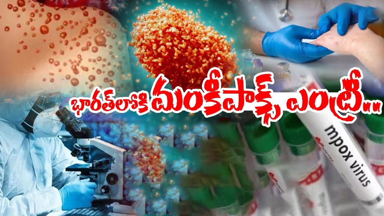 Monkeypox Case in India: ఇండియాలోకి మంకీపాక్స్ ఎంట్రీ.. తొలి కేసు ఎక్కడంటే..?