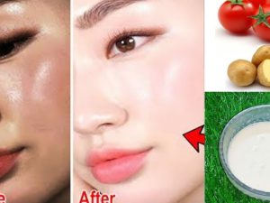 Tomato and Potato Face Pack: ఈ ఫేస్ ప్యాక్‌కు ఎవ్వరైనా ఫిదా అవ్వాల్సిందే !