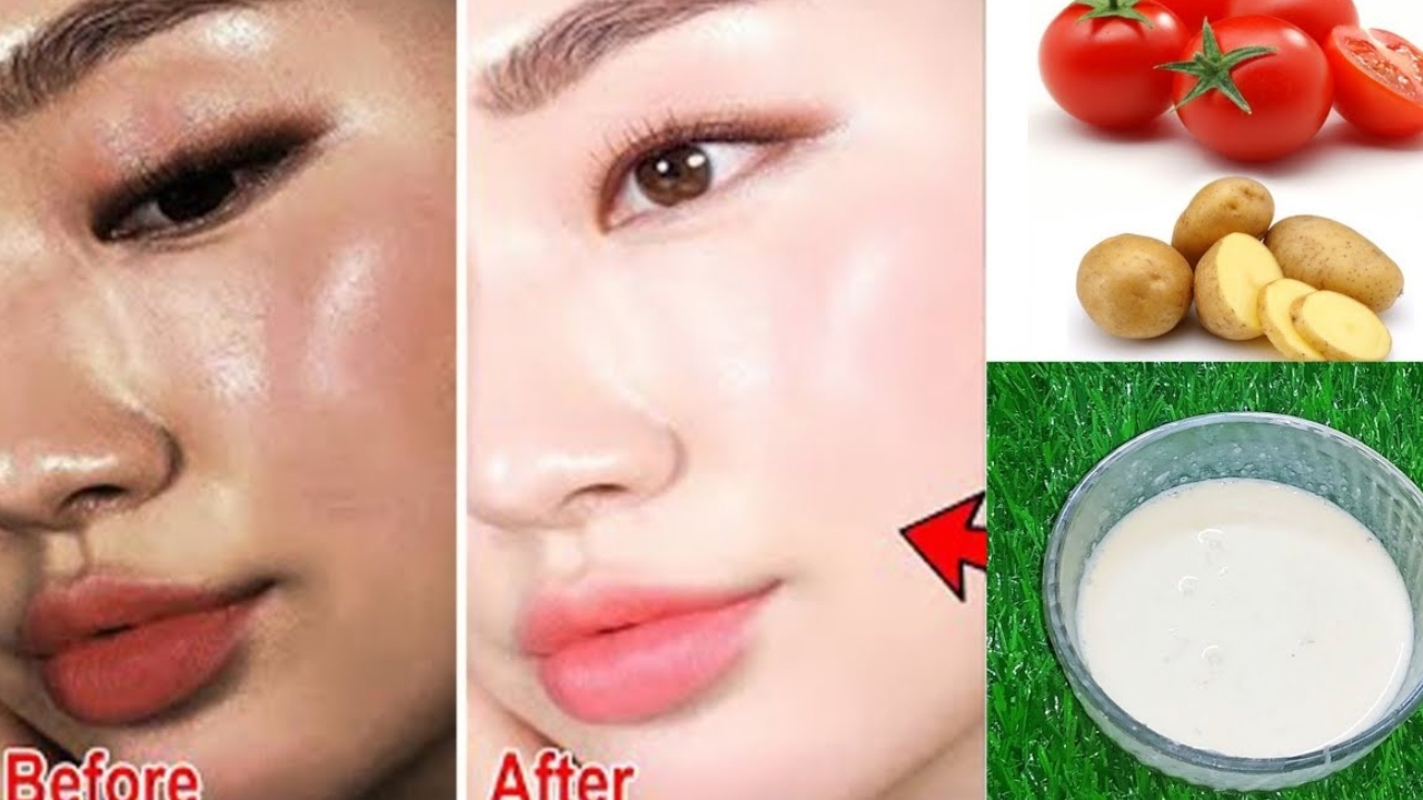 Tomato and Potato Face Pack: ఈ ఫేస్ ప్యాక్‌కు ఎవ్వరైనా ఫిదా అవ్వాల్సిందే !