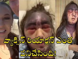 Alexis Lorenze Viral: టెటనస్ వ్యాక్సిన్ తీసుకోగానే సీరియస్ రియాక్షన్.. చావుబతుకుల్లో యువతి