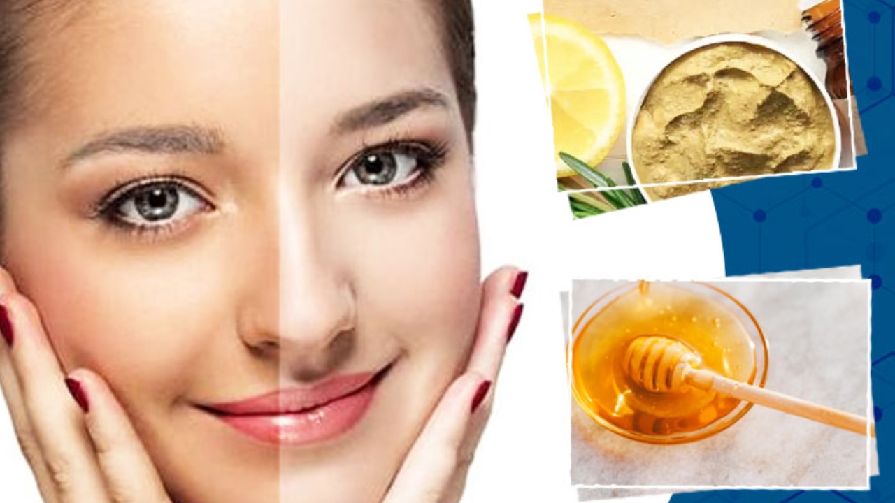 Home Remedies For Tan: వీటితో ఫేస్‌పై ఉన్న జిడ్డు మాయం