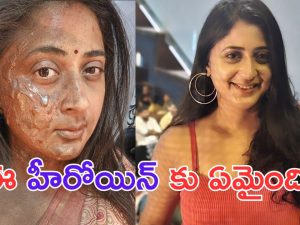 Kaniha: ఒట్టేసి చెబుతున్నా హీరోయిన్ కు ఏమైంది.. ముఖం మొత్తం కాలిపోయి.. ఇంత భయంకరంగా