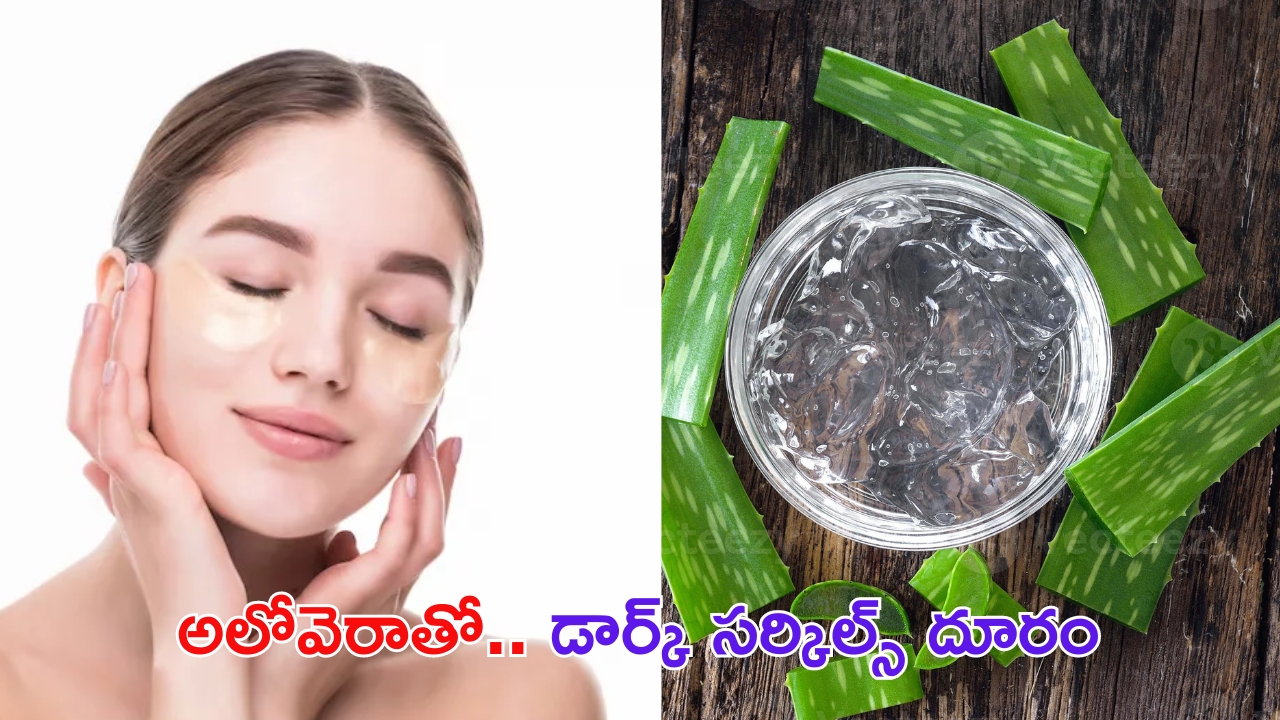 Aloe Vera For Dark Circles: అలోవెరాతో డార్క్ సర్కిల్స్ దూరం