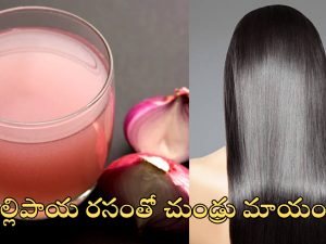 Dandruff Home Remedies: ఇంట్లోనే చుండ్రు తగ్గించుకోండిలా ?