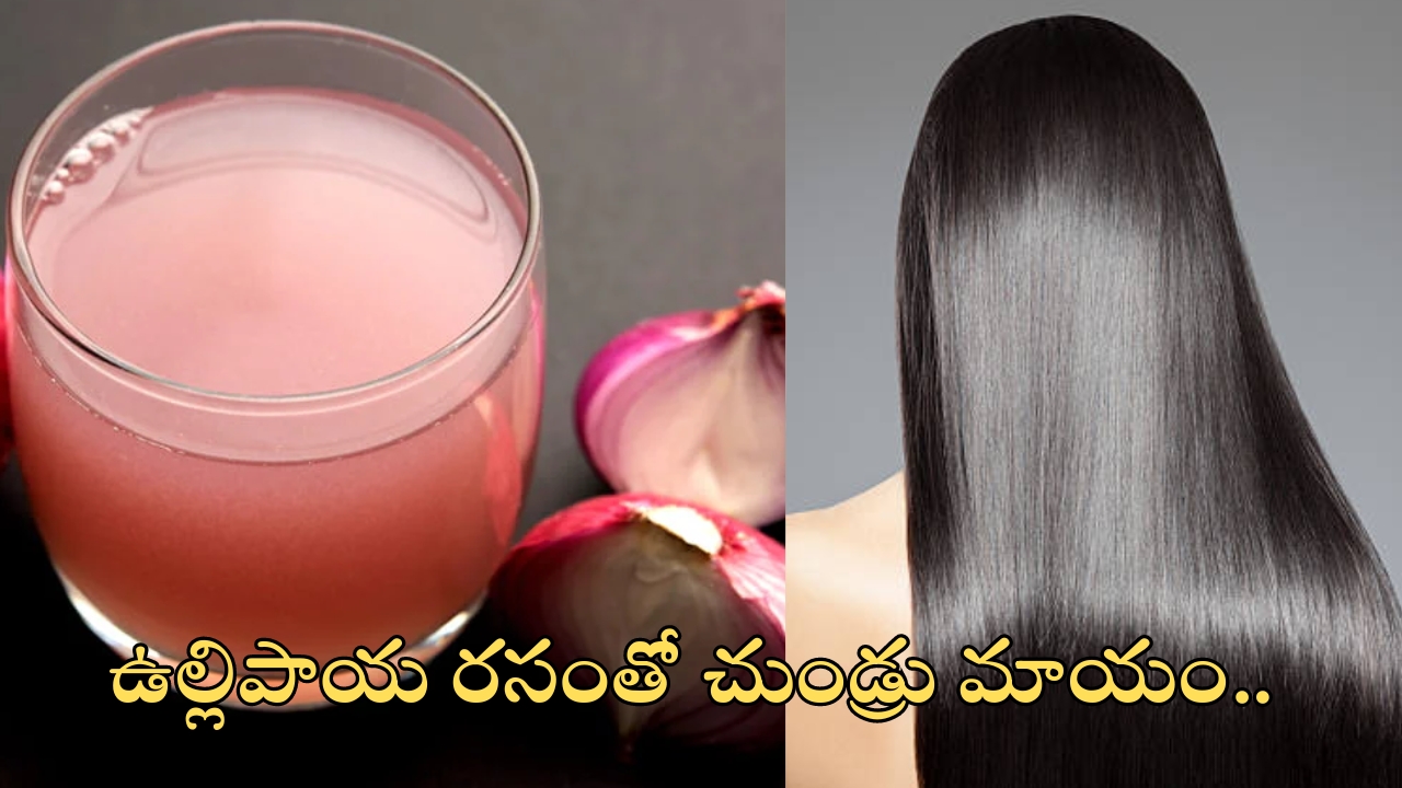 Dandruff Home Remedies: ఇంట్లోనే చుండ్రు తగ్గించుకోండిలా ?