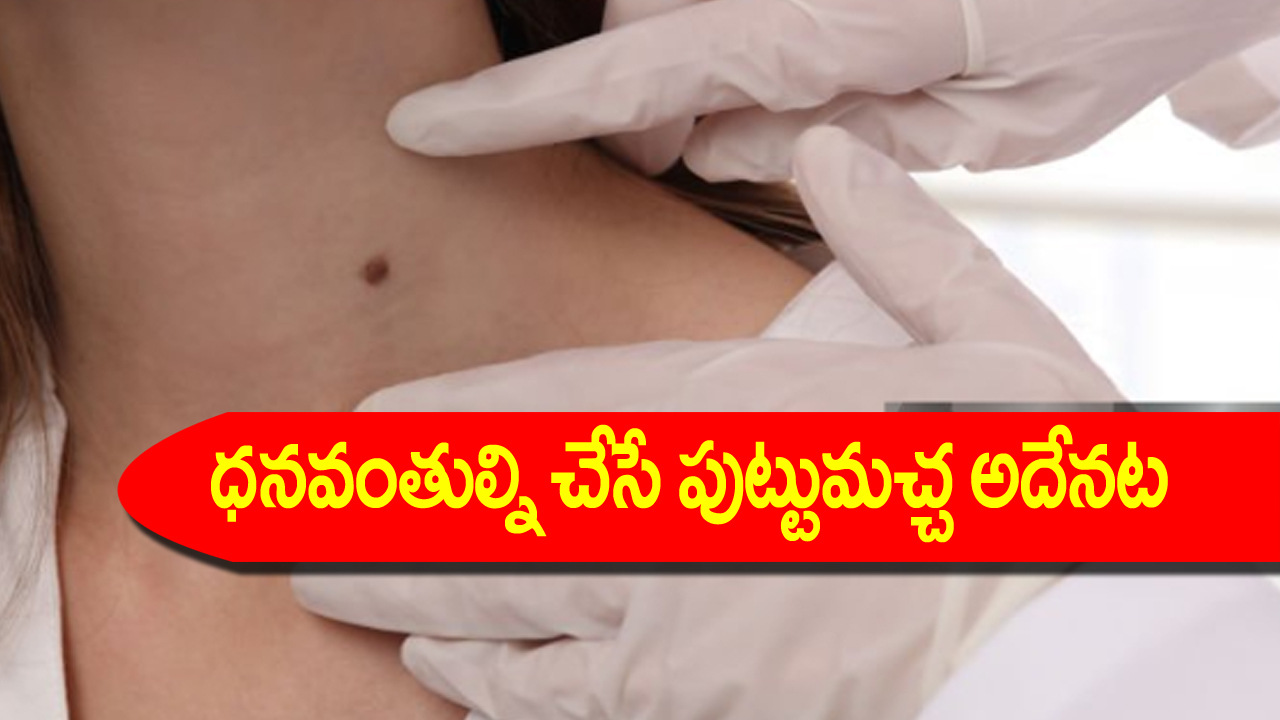 Lucky moles: ధనవంతుల్ని చేసే పుట్టుమచ్చలు ఎక్కడెక్కడ ఉంటాయో తెలుసా? ఇప్పుడే చెక్ చేసుకోండి