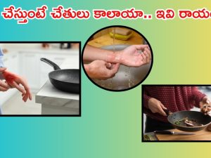 Home Remedies: వంట గదిలో చేతులు కాలాయా ? ఇవి రాయండి