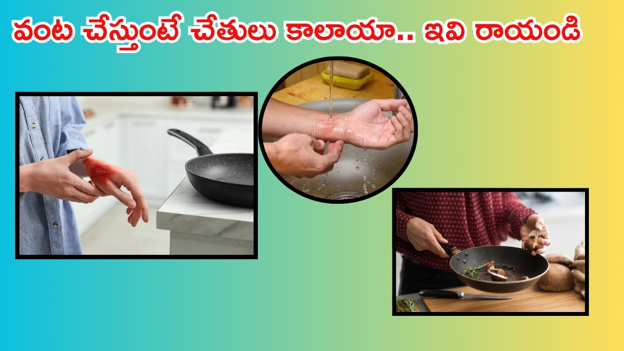 Home Remedies: వంట గదిలో చేతులు కాలాయా ? ఇవి రాయండి