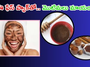 Cinnamon Face Pack: ఈ ఫేస్ ప్యాక్‌‌తో ముఖంపై మొటిమలు మాయం